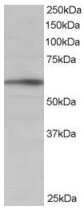 Western blot - Anti-IRSp53 antibody - C-terminal (AB15697)