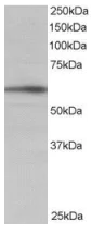 Western blot - Anti-IRSp53 antibody - C-terminal (AB15697)