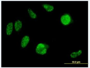 Immunocytochemistry/ Immunofluorescence - Anti-IRX2 antibody (AB72975), expandable thumbnail