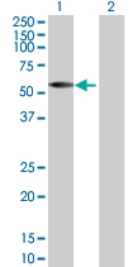 Western blot - Anti-IRX2 antibody (AB72975), expandable thumbnail