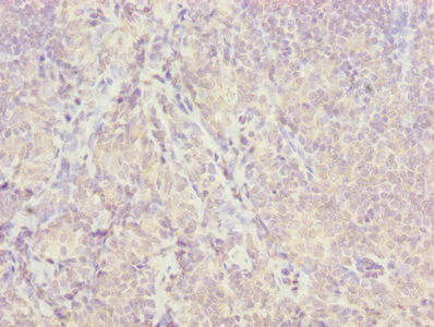 Immunohistochemistry (Formalin/PFA-fixed paraffin-embedded sections) - Anti-ISCA2 antibody (AB235776)