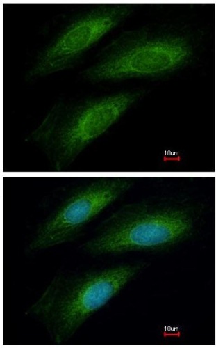 Immunocytochemistry/ Immunofluorescence - Anti-ISCU antibody (AB154060), expandable thumbnail