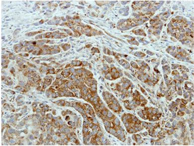 Immunohistochemistry (Formalin/PFA-fixed paraffin-embedded sections) - Anti-ISCU antibody (AB154060)
