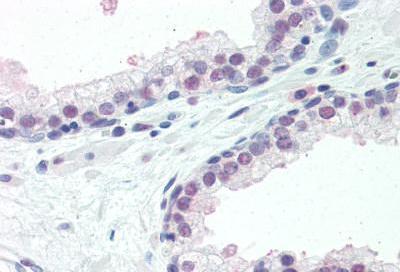 Immunohistochemistry (Formalin/PFA-fixed paraffin-embedded sections) - Anti-ISG15 antibody (AB131119)