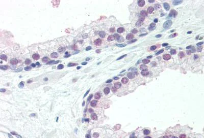 Immunohistochemistry (Formalin/PFA-fixed paraffin-embedded sections) - Anti-ISG15 antibody (AB131119)