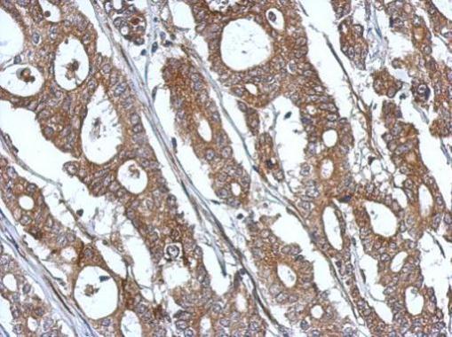 Immunohistochemistry (Formalin/PFA-fixed paraffin-embedded sections) - Anti-ISG15 antibody (AB227541)