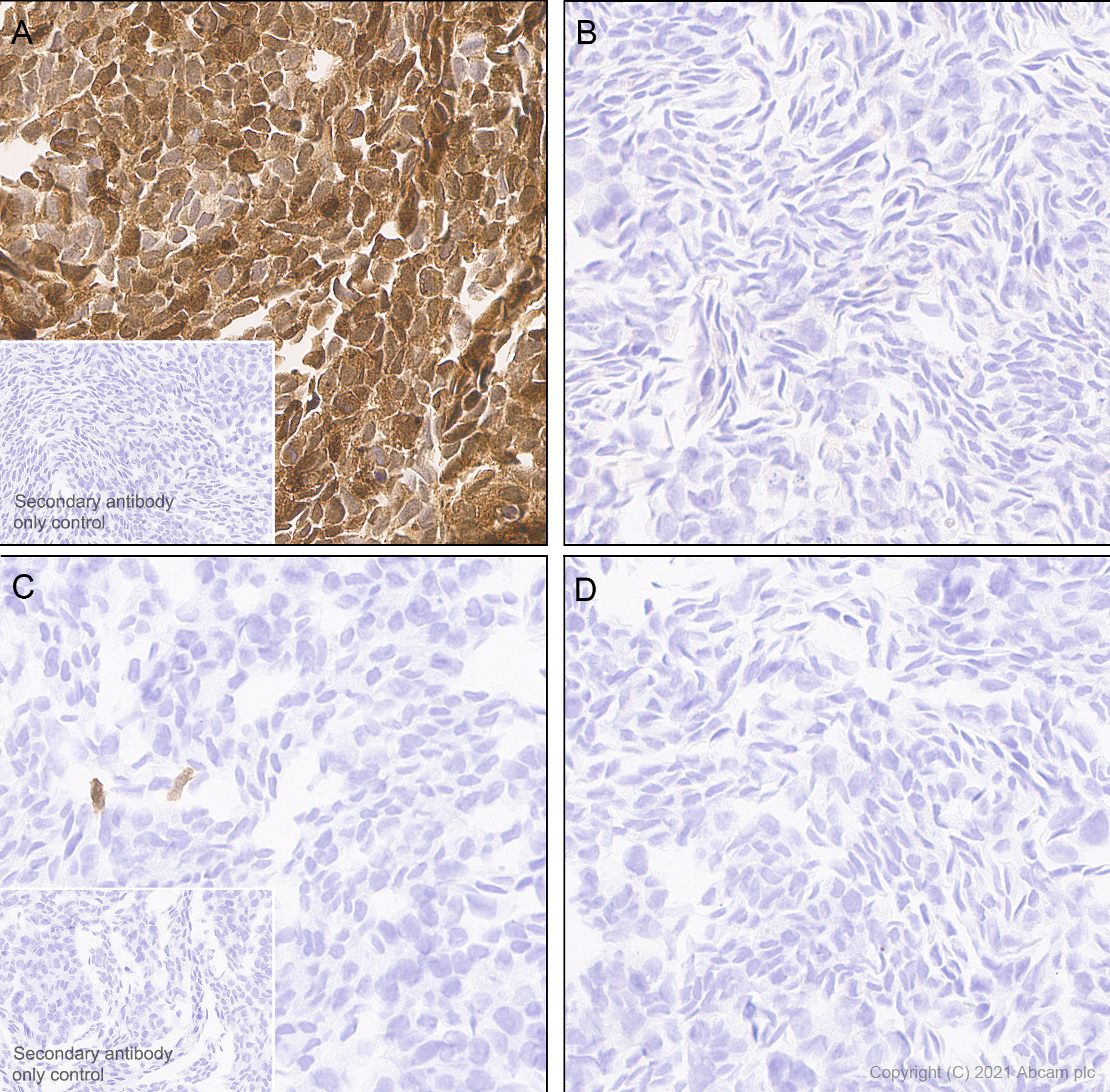 Immunohistochemistry (Formalin/PFA-fixed paraffin-embedded sections) - Anti-ISG15 antibody [EPR24482-49] (AB285367)