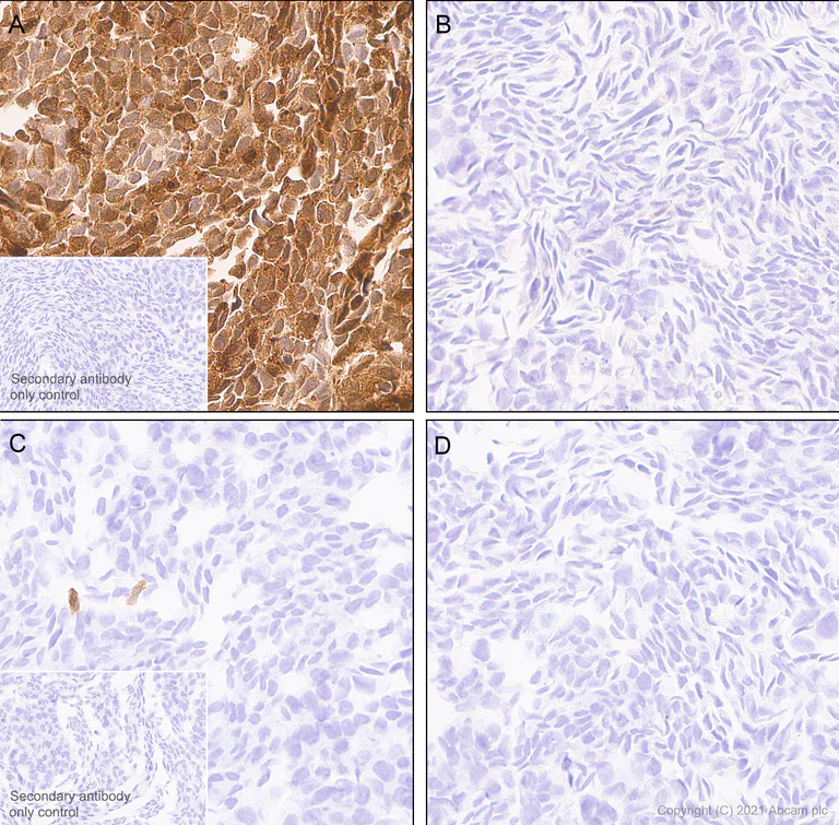 Immunohistochemistry (Formalin/PFA-fixed paraffin-embedded sections) - Anti-ISG15 antibody [EPR24482-49] (AB285367)
