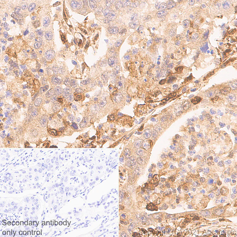 Immunohistochemistry (Formalin/PFA-fixed paraffin-embedded sections) - Anti-ISG15 antibody [EPR24482-49] (AB285367)