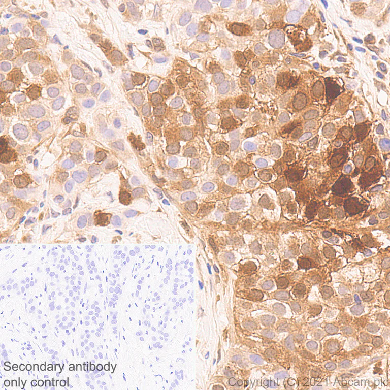 Immunohistochemistry (Formalin/PFA-fixed paraffin-embedded sections) - Anti-ISG15 antibody [EPR24482-49] - BSA and Azide free (AB285370)