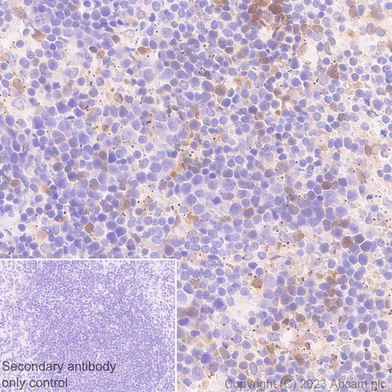 Immunohistochemistry (Formalin/PFA-fixed paraffin-embedded sections) - Anti-ISG15 antibody [EPR28318-62] (AB315281)