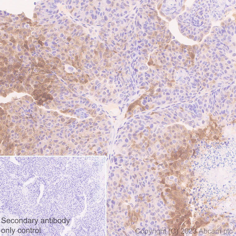 Immunohistochemistry (Formalin/PFA-fixed paraffin-embedded sections) - Anti-ISG15 antibody [EPR28318-62] (AB315281)