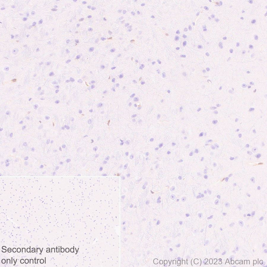 Immunohistochemistry (Formalin/PFA-fixed paraffin-embedded sections) - Anti-ISG15 antibody [EPR28318-62] (AB315281)