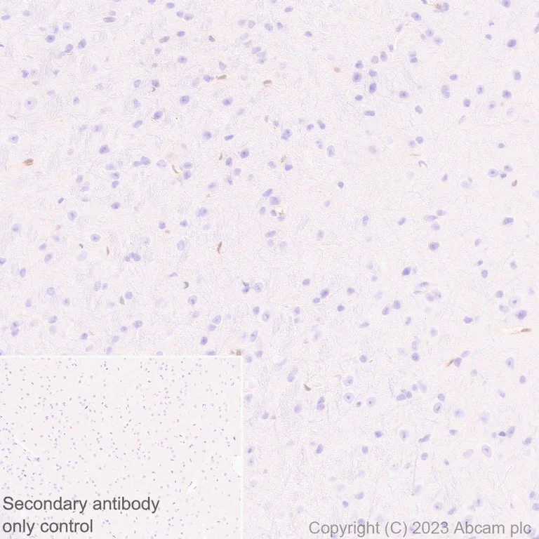 Immunohistochemistry (Formalin/PFA-fixed paraffin-embedded sections) - Anti-ISG15 antibody [EPR28318-62] (AB315281)