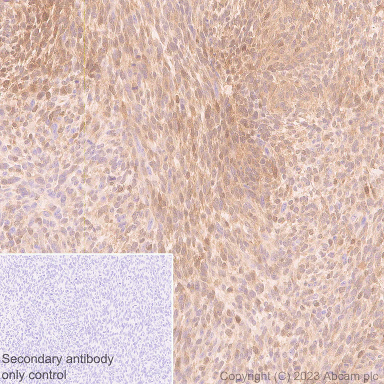 Immunohistochemistry (Formalin/PFA-fixed paraffin-embedded sections) - Anti-ISG15 antibody [EPR28318-62] - BSA and Azide free (AB315282)