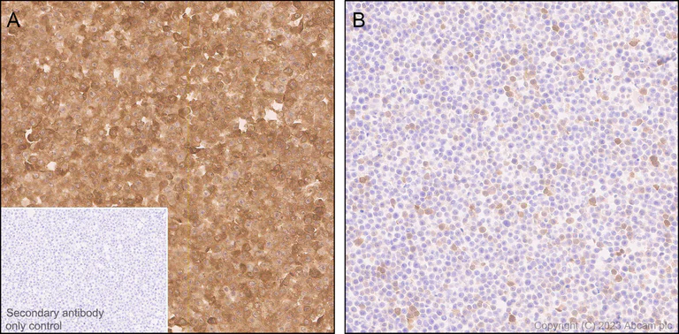 Immunohistochemistry (Formalin/PFA-fixed paraffin-embedded sections) - Anti-ISG15 antibody [EPR28318-62] - BSA and Azide free (AB315282)