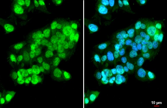 Immunocytochemistry/ Immunofluorescence - Anti-ISG15 antibody [HL2017] (AB308219), expandable thumbnail