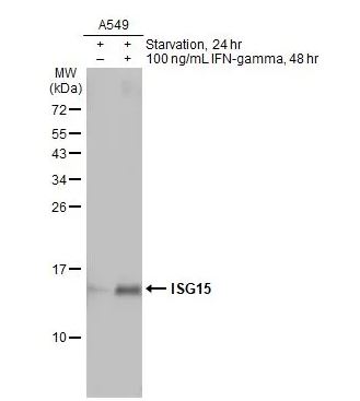 Western blot - Anti-ISG15 antibody [HL2017] (AB308219), expandable thumbnail