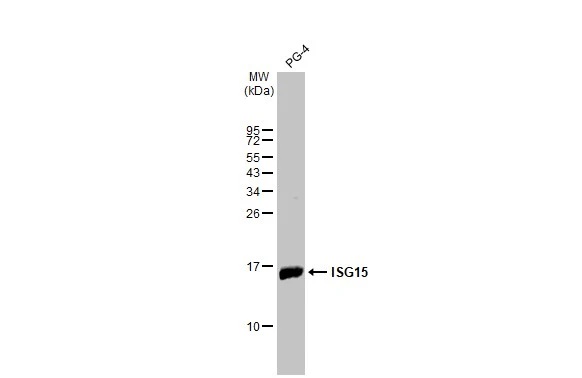 Western blot - Anti-ISG15 antibody [HL2017] (AB308219), expandable thumbnail