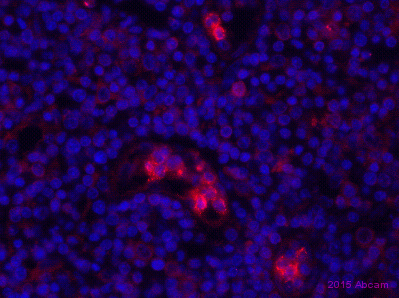 Immunohistochemistry (Formalin/PFA-fixed paraffin-embedded sections) - Anti-ISG20 antibody (AB154393), expandable thumbnail