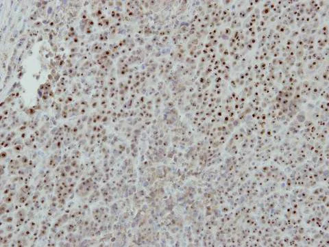 Immunohistochemistry (Formalin/PFA-fixed paraffin-embedded sections) - Anti-ISG20 antibody (AB154393)