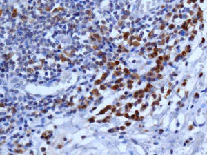 Immunohistochemistry (Formalin/PFA-fixed paraffin-embedded sections) - Anti-ISG20 antibody [EPR8973] (AB157477)