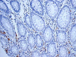 Immunohistochemistry (Formalin/PFA-fixed paraffin-embedded sections) - Anti-ISG20 antibody [EPR8973] (AB157477)