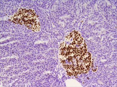 Immunohistochemistry (Formalin/PFA-fixed paraffin-embedded sections) - Anti-Islet 1 antibody [1B1] (AB86501), expandable thumbnail