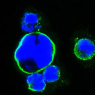 Immunocytochemistry/ Immunofluorescence - Anti-Islet 1 antibody [1H9] (AB86472), expandable thumbnail