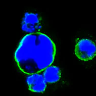 Immunocytochemistry/ Immunofluorescence - Anti-Islet 1 antibody [1H9] - Neural Stem Cell Marker (AB86472)