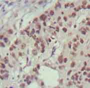 Immunohistochemistry (Formalin/PFA-fixed paraffin-embedded sections) - Anti-Islet 1 antibody [1H9] - Neural Stem Cell Marker (AB86472), expandable thumbnail