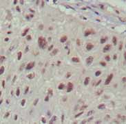Immunohistochemistry (Formalin/PFA-fixed paraffin-embedded sections) - Anti-Islet 1 antibody [1H9] - Neural Stem Cell Marker (AB86472), expandable thumbnail