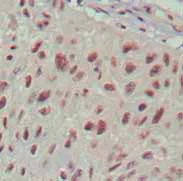 Immunohistochemistry (Formalin/PFA-fixed paraffin-embedded sections) - Anti-Islet 1 antibody [1H9] - Neural Stem Cell Marker (AB86472)
