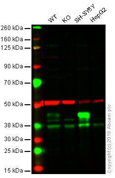 Western blot - Anti-Islet 1 antibody [1H9] - Neural Stem Cell Marker (AB86472), expandable thumbnail
