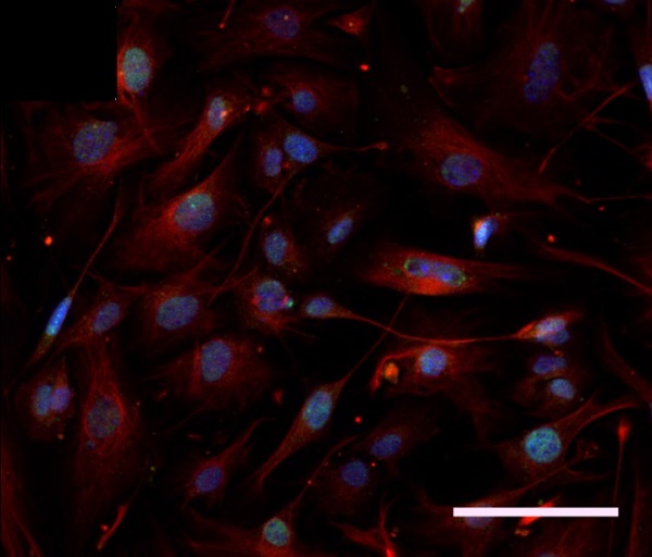 Immunocytochemistry/ Immunofluorescence - Anti-Islet 1 antibody (AB20670), expandable thumbnail