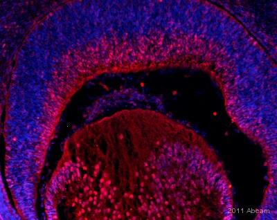 Immunohistochemistry (Frozen sections) - Anti-Islet 1 antibody (ab20670), expandable thumbnail