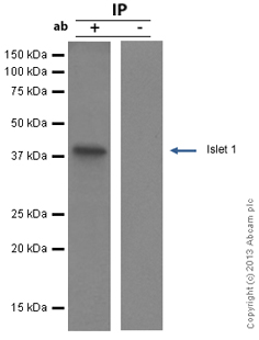 Immunoprecipitation - Anti-Islet 1 antibody [EP4182] - BSA and Azide free (AB216657), expandable thumbnail