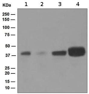 Western blot - Anti-Islet 1 antibody [EP4182] - Neural Stem Cell Marker (AB109517), expandable thumbnail
