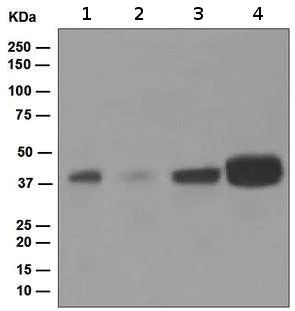 Western blot - Anti-Islet 1 antibody [EP4182] - Neural Stem Cell Marker (AB109517)