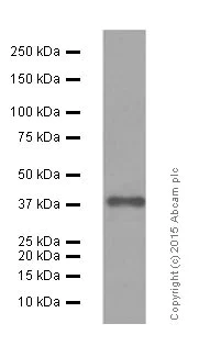 Western blot - Anti-Islet 1 antibody [EP4182] - Neural Stem Cell Marker (AB109517)