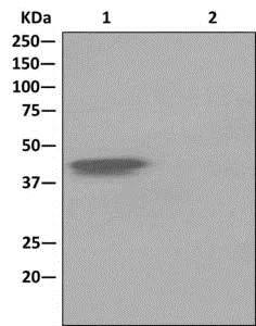 Immunoprecipitation - Anti-Islet 1 antibody [EPR10362] - BSA and Azide free (AB238919)