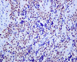 Immunohistochemistry (Formalin/PFA-fixed paraffin-embedded sections) - Anti-Islet 1 antibody [EPR10362] (ab178400), expandable thumbnail