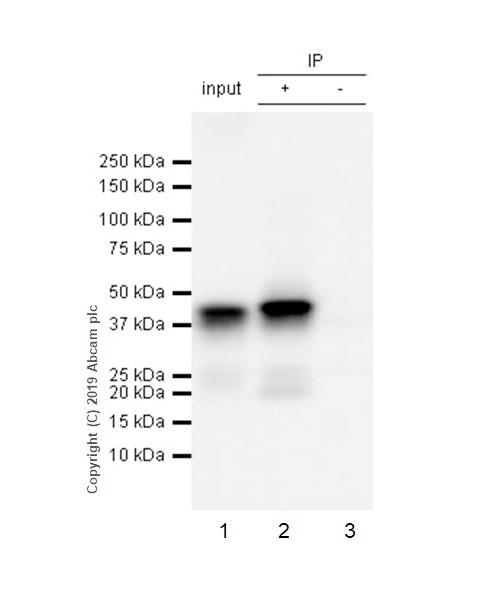Immunoprecipitation - Anti-Islet 1 antibody [EPR10362] - Neural Stem Cell Marker (AB178400), expandable thumbnail