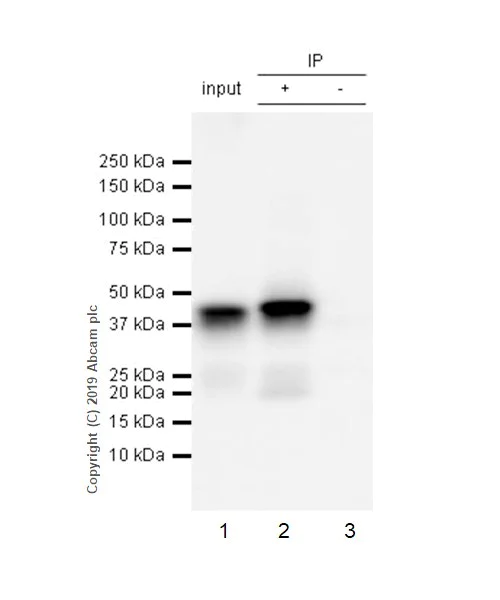 Immunoprecipitation - Anti-Islet 1 antibody [EPR10362] - Neural Stem Cell Marker (AB178400)
