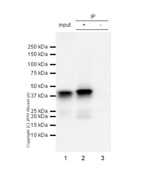 Immunoprecipitation - Anti-Islet 1 antibody [EPR10362] - Neural Stem Cell Marker (AB178400), expandable thumbnail
