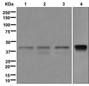 Western blot - Anti-Islet 1 antibody [EPR10362] - Neural Stem Cell Marker (AB178400)