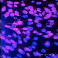 Immunocytochemistry/ Immunofluorescence - Anti-Islet 1 antibody - Neural Stem Cell Marker (AB20670)