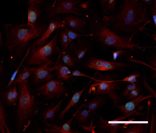 Immunocytochemistry/ Immunofluorescence - Anti-Islet 1 antibody - Neural Stem Cell Marker (AB20670)