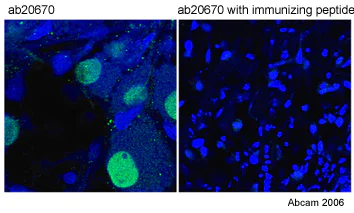 Immunocytochemistry/ Immunofluorescence - Anti-Islet 1 antibody - Neural Stem Cell Marker (AB20670)