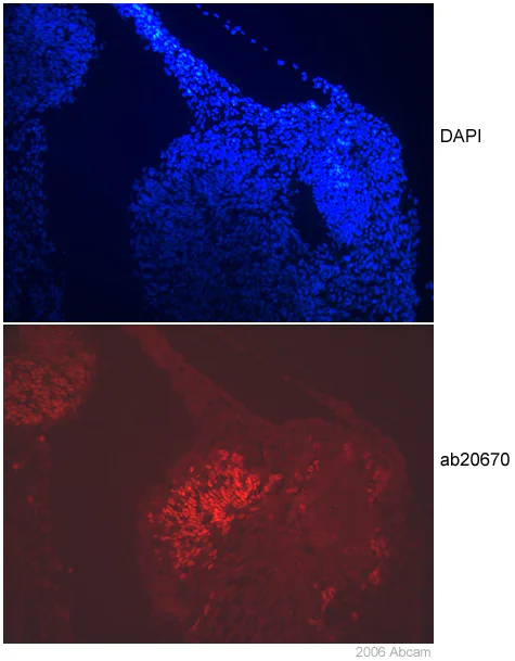 Immunohistochemistry (Frozen sections) - Anti-Islet 1 antibody - Neural Stem Cell Marker (AB20670)
